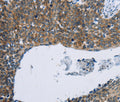 KPNB1 Polyclonal Antibody – Figure 1 of 3