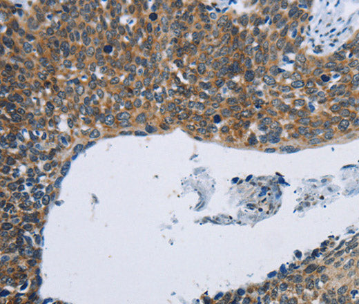 KPNB1 Polyclonal Antibody – Figure 1 of 3