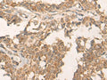 ATR Polyclonal Antibody – Figure 1 of 2