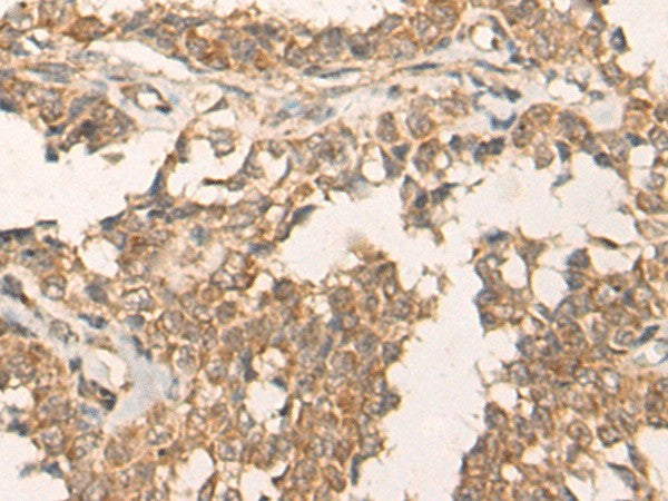 ATR Polyclonal Antibody – Figure 1 of 2