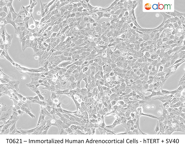 Immortalized Human Adrenocortical Cells - hTERT + SV40 | Applied Biological Materials (abm)