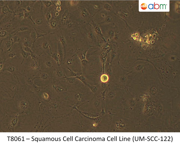 Squamous Cell Carcinoma Cell Line (UM-SCC-122) | Applied Biological Materials (abm)