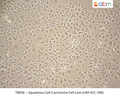 Squamous Cell Carcinoma Cell Line (UM-SCC-106) | Applied Biological Materials (abm)
