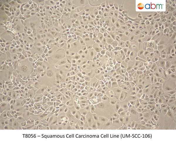 Squamous Cell Carcinoma Cell Line (UM-SCC-106) | Applied Biological Materials (abm)