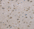 FAP Polyclonal Antibody – Figure 1 of 3