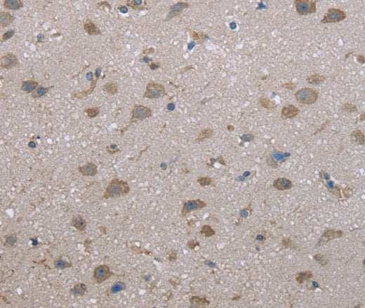 FAP Polyclonal Antibody – Figure 1 of 3