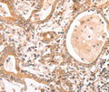 ABCF1 Polyclonal Antibody – Figure 1 of 3