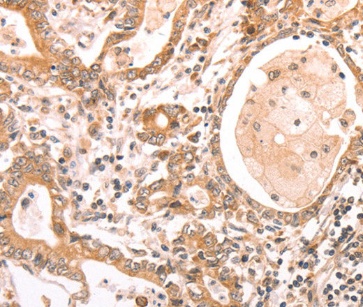 ABCF1 Polyclonal Antibody – Figure 1 of 3