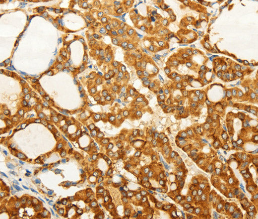FZD6 Polyclonal Antibody – Figure 1 of 3