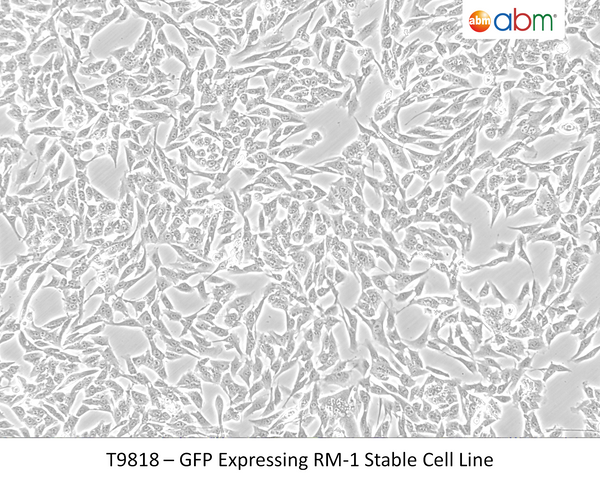 GFP Expressing RM-1 Stable Cell Line | Applied Biological Materials (abm)
