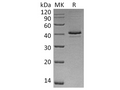 Recombinant Human CAMK1/CaMKI-alpha Protein (His Tag) – Figure 1 of 2