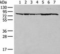 TUBGCP4 Polyclonal Antibody – Figure 1 of 2
