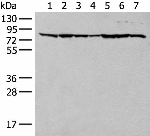 TUBGCP4 Polyclonal Antibody – Figure 1 of 2
