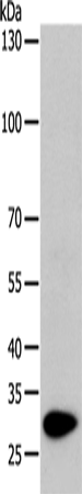 TPM1 Polyclonal Antibody – Figure 1 of 4