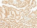 BICRA Polyclonal Antibody – Figure 1 of 2