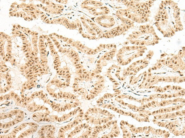 BICRA Polyclonal Antibody – Figure 1 of 2