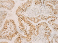 RFX6 Polyclonal Antibody – Figure 1 of 2