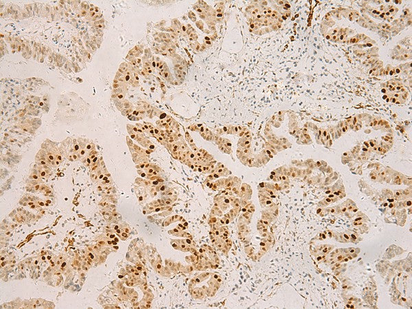 RFX6 Polyclonal Antibody – Figure 1 of 2
