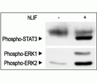 Recombinant human LIF protein
