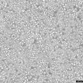 L-540 cell