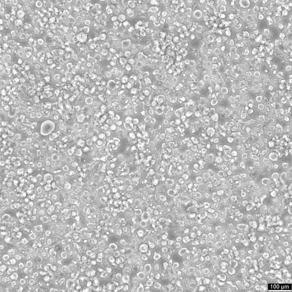 L-540 cell