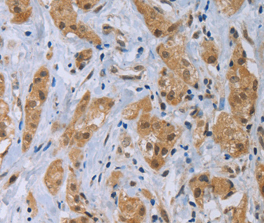 CLEC1A Polyclonal Antibody – Figure 1 of 3