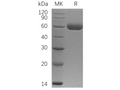 Recombinant Human Osteoprotegerin/TNFRSF11B Protein (His Tag) – Figure 1 of 3