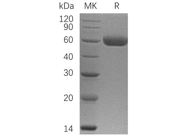 Recombinant Human Osteoprotegerin/TNFRSF11B Protein (His Tag) – Figure 1 of 3