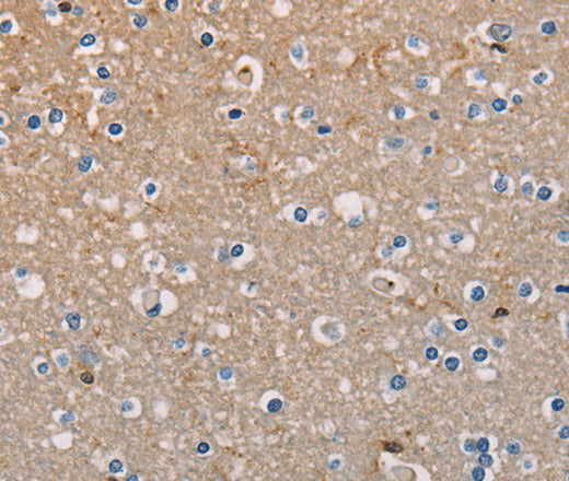 AMBRA1 Polyclonal Antibody – Figure 1 of 3