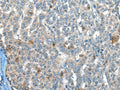CAPN3 Polyclonal Antibody – Figure 1 of 2