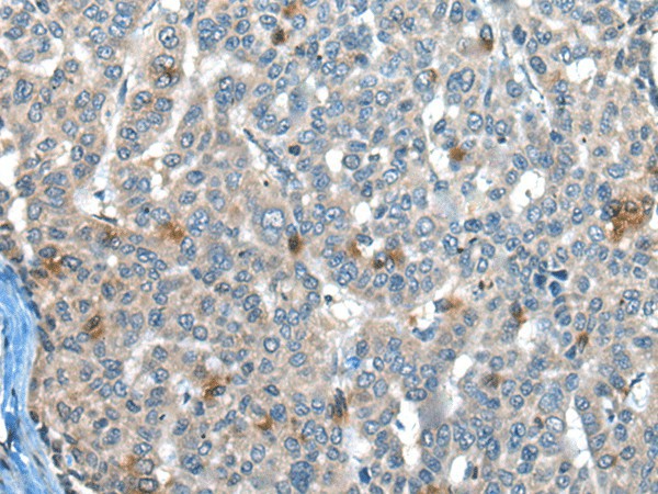 CAPN3 Polyclonal Antibody – Figure 1 of 2