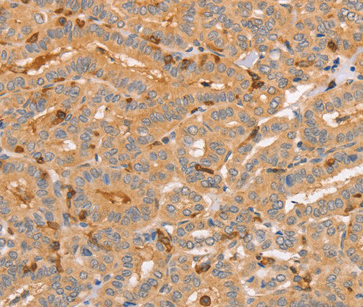 CCL16 Polyclonal Antibody – Figure 1 of 3
