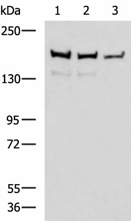 ROCK2 Polyclonal Antibody – Figure 1 of 2