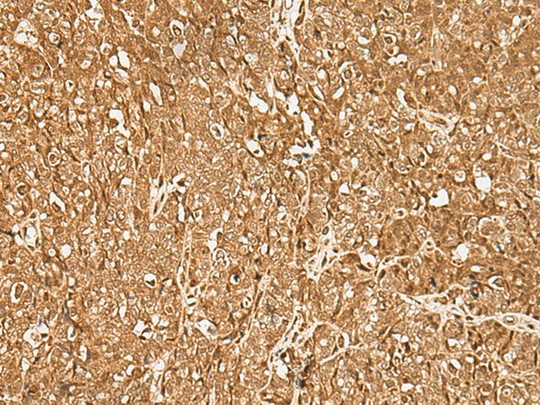 GMEB2 Polyclonal Antibody – Figure 1 of 3