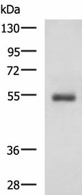 RHCG Polyclonal Antibody – Figure 1 of 3