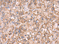 KCNN1 Polyclonal Antibody – Figure 1 of 3