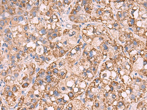 KCNN1 Polyclonal Antibody – Figure 1 of 3