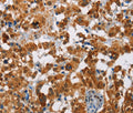 ATXN1 Polyclonal Antibody – Figure 1 of 3