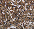 GLIPR1 Polyclonal Antibody – Figure 1 of 3