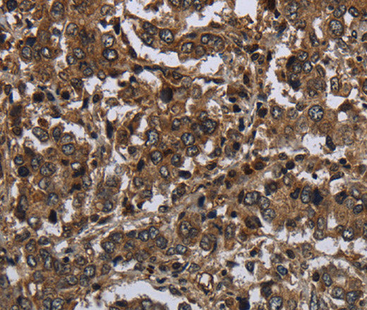 GLIPR1 Polyclonal Antibody – Figure 1 of 3
