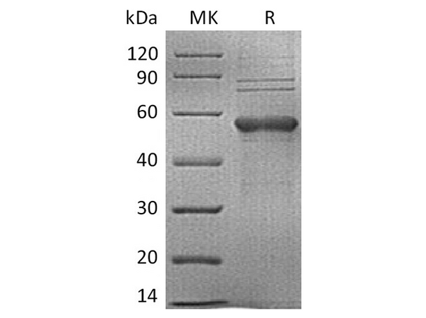 Recombinant Human TIM-3/HAVCR2 Protein (mFc Tag) – Figure 1 of 2