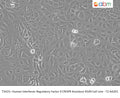 IRF9 CRISPR Knockout A549 Cell Line - T2 AA201 | Applied Biological Materials (abm)