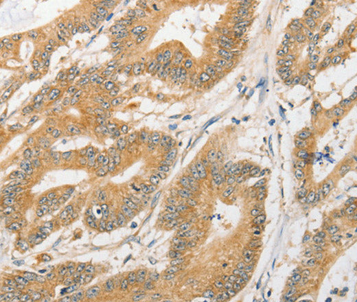 ATG5 Polyclonal Antibody – Figure 1 of 3
