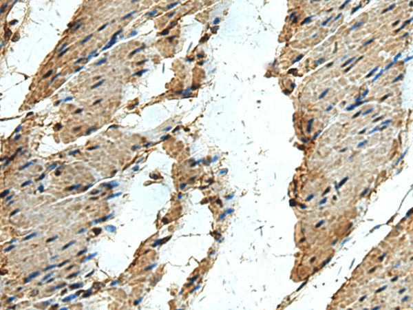 ERLIN1 Polyclonal Antibody – Figure 1 of 2