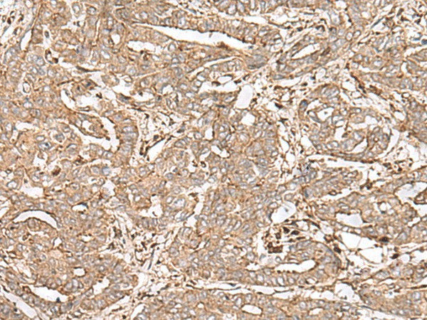 FAAP24 Polyclonal Antibody – Figure 1 of 3