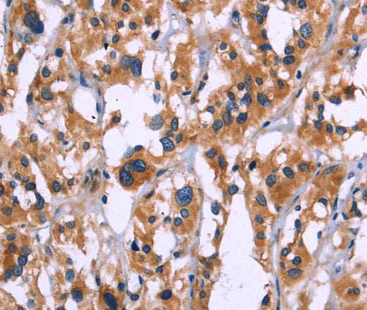 ZEB2 Polyclonal Antibody – Figure 1 of 3