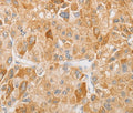 NGF Polyclonal Antibody – Figure 1 of 2