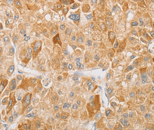NGF Polyclonal Antibody – Figure 1 of 2