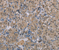 MGLL Polyclonal Antibody – Figure 1 of 3