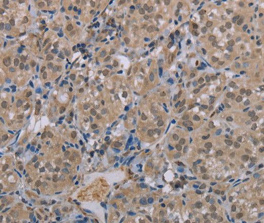MGLL Polyclonal Antibody – Figure 1 of 3